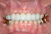 orthodontics,after,񋸐,Ì,gvbdo,G.V. BLACK DENTAL OFFICE,