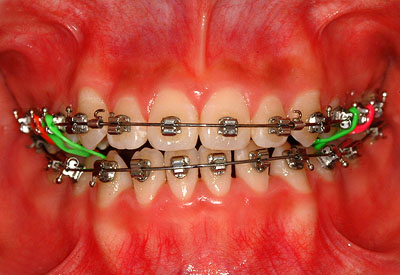 񋸐,w,],,w,R~,ǂ,摜, ,Ȉ@,Vh,X؏㌴,k,o,wO,o,VSu,c,͑,GVBDO,G.V. BLACK DENTAL OFFICE,