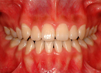 񋸐,d,w,],uO,R~,ǂ,摜,,Ȉ@,Vh,X؏㌴,k,o,wO,o,VSu,c,͑,GVBDO,G.V. BLACK DENTAL OFFICE,