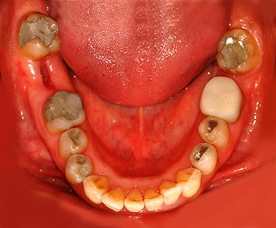 Cvg,sv,֎,Ȏ,,Ƃ́H,,摜,t,Ǘ,,GVBDO, G.V. BLACK DENTAL OFFICE