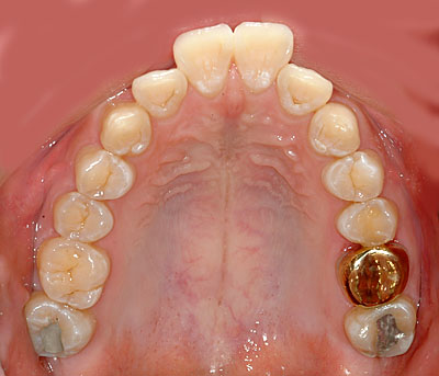 ݍ킹, , {֐ߏ, , , l, ,_a, т傤, psychosis, ϑz, o, , Ǐ, , Ǐ, _aQ, psychotic, disorder, _, _Q, Na, , G.V. BLACK DENTAL OFFICE, GVBDO