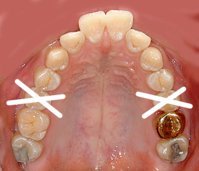 ݍ킹, , {֐ߏ, , , l, ,_a, т傤, psychosis, ϑz, o, , Ǐ, , Ǐ, _aQ, psychotic, disorder, _, _Q, Na, , G.V. BLACK DENTAL OFFICE, GVBDO