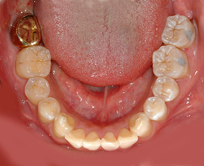 ݍ킹, , {֐ߏ, , , l, ,_a, т傤, psychosis, ϑz, o, , Ǐ, , Ǐ, _aQ, psychotic, disorder, _, _Q, Na, , G.V. BLACK DENTAL OFFICE, GVBDO