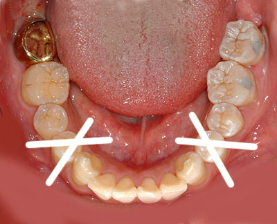 ݍ킹, , {֐ߏ, , , l, ,_a, т傤, psychosis, ϑz, o, , Ǐ, , Ǐ, _aQ, psychotic, disorder, _, _Q, Na, , G.V. BLACK DENTAL OFFICE, GVBDO