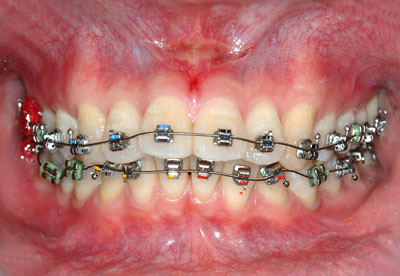 ݍ킹, , {֐ߏ, , , l, ,_a, т傤, psychosis, ϑz, o, , Ǐ, , Ǐ, _aQ, psychotic, disorder, _, _Q, Na, , G.V. BLACK DENTAL OFFICE, GVBDO