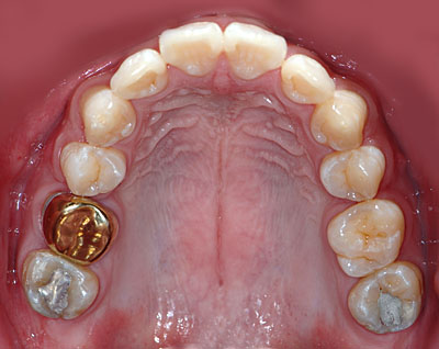 ݍ킹, , {֐ߏ, , , l, ,_a, т傤, psychosis, ϑz, o, , Ǐ, , Ǐ, _aQ, psychotic, disorder, _, _Q, Na, , G.V. BLACK DENTAL OFFICE, GVBDO,