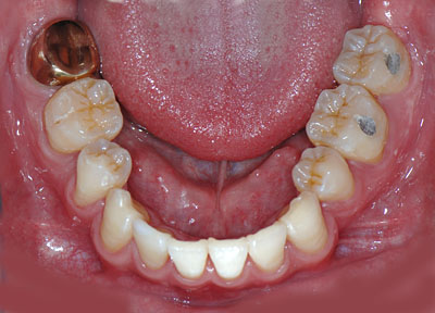 ݍ킹, , {֐ߏ, , , l, ,_a, т傤, psychosis, ϑz, o, , Ǐ, , Ǐ, _aQ, psychotic, disorder, _, _Q, Na, , G.V. BLACK DENTAL OFFICE, GVBDO