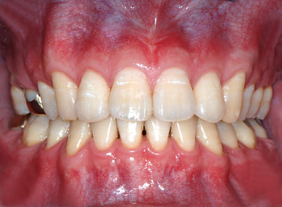 ݍ킹, , {֐ߏ, , , l, ,_a, т傤, psychosis, ϑz, o, , Ǐ, , Ǐ, _aQ, psychotic, disorder, _, _Q, Na, , G.V. BLACK DENTAL OFFICE, GVBDO,