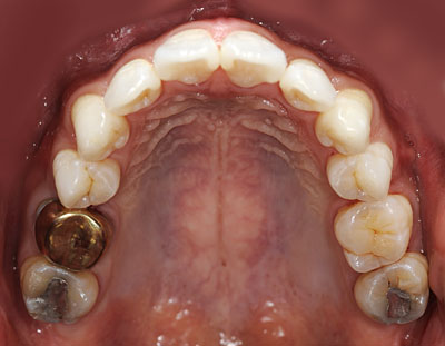 ݍ킹, , {֐ߏ, , , l, ,_a, т傤, psychosis, ϑz, o, , Ǐ, , Ǐ, _aQ, psychotic, disorder, _, _Q, Na, , G.V. BLACK DENTAL OFFICE, GVBDO