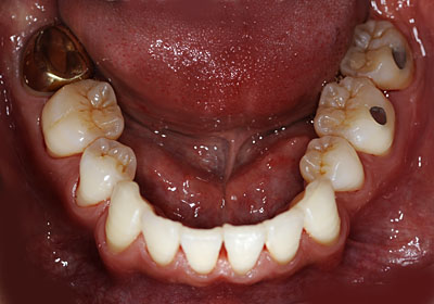 ݍ킹, , {֐ߏ, , , l, ,_a, т傤, psychosis, ϑz, o, , Ǐ, , Ǐ, _aQ, psychotic, disorder, _, _Q, Na, , G.V. BLACK DENTAL OFFICE, GVBDO