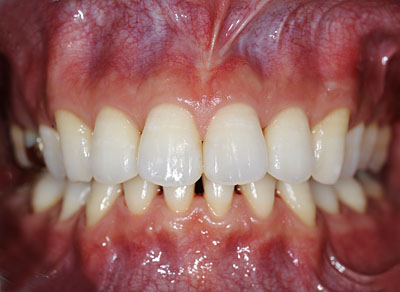 ݍ킹, , {֐ߏ, , , l, ,_a, т傤, psychosis, ϑz, o, , Ǐ, , Ǐ, _aQ, psychotic, disorder, _, _Q, Na, , G.V. BLACK DENTAL OFFICE, GVBDO